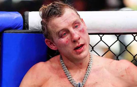 Пимблетт прокомментировал поражение Гэтжи