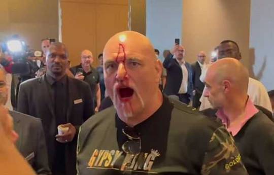 Fury's father smashed his head to blood during a scuffle with Usik's team (video)