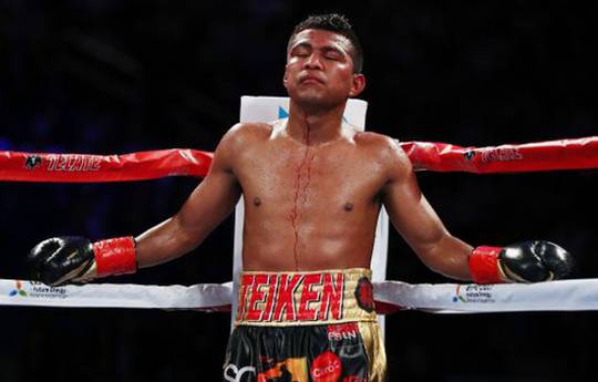 Chocolatito's return to ring targeted for Sept.