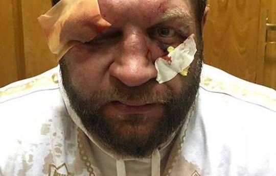 Drunken MMA fighter Alexander Emelianenko had an accident trying to escape from a tow truck