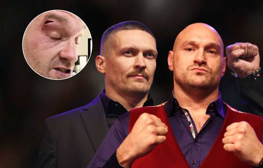 Usik's promoter told his version of how Fury got cut