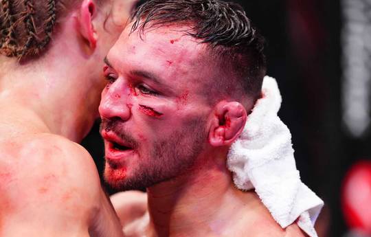 Чендлер - про UFC: "Платять бійцям більше, ніж про те говорять"