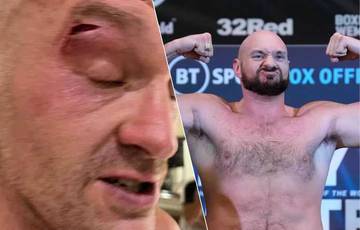 Ukrainian trainer Korch: “I think Fury’s cut is real”