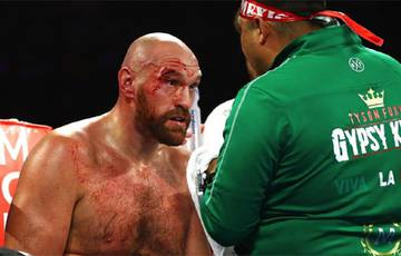 Fury tendrá un nuevo cutman