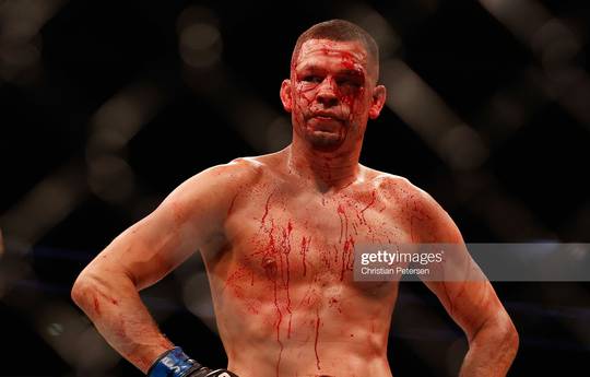 Nate Diaz wants to return in 3-4 months