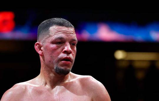 Trainer nennt Bedingung für Diaz' Rückkehr in die UFC