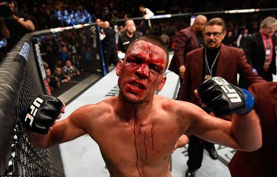 Nate Diaz's Coach: We Want $20 Mil to Fight Conor McGregor, At Least!