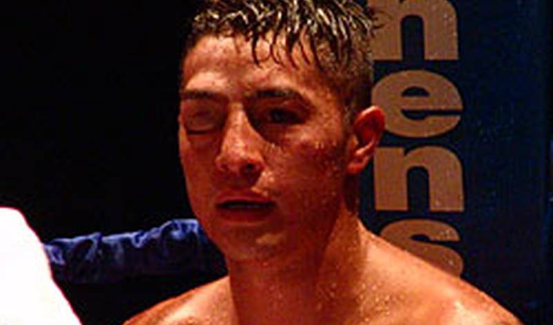 Фуентес после того, как он пропустил удар левой в глаз