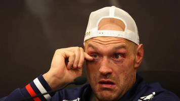 Tyson Fury Retires From Boxing at the Age of 36 After Losing To Usyk Twice