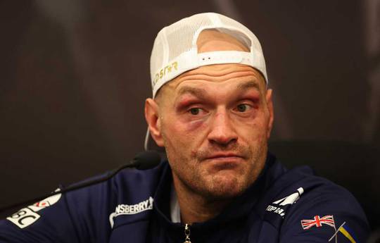 Fury named the toughest opponent of his career