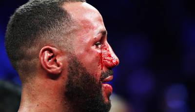 DeGale lost teeth, his cool and hearing but kept his super-middleweight title