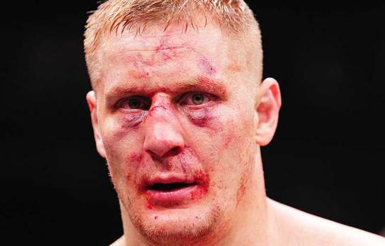 Volkov broke Pavlovic's nose