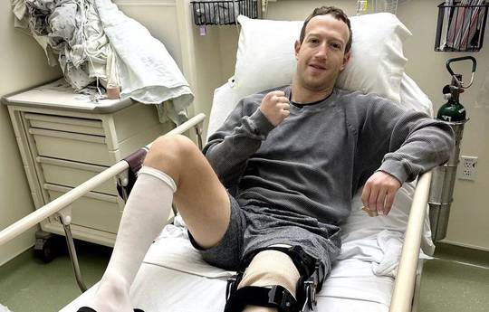 Zuckerberg was seriously injured while preparing for the fight (PHOTOS)