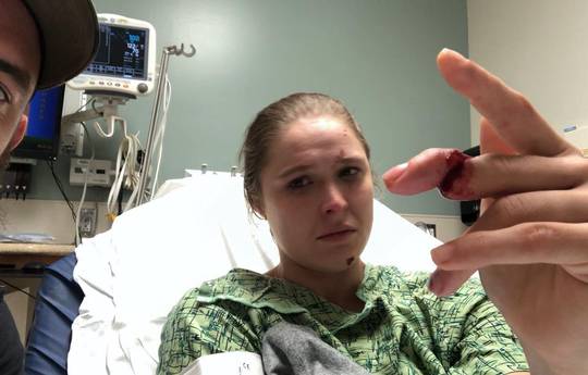 Ronda Rousey almost lose her finger at the series shooting