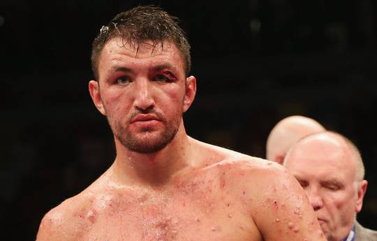 Peter Fury: “Hughie has to prove people wrong, just like Tyson did”