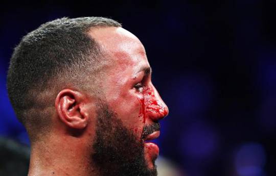 DeGale lost teeth, his cool and hearing but kept his super-middleweight title