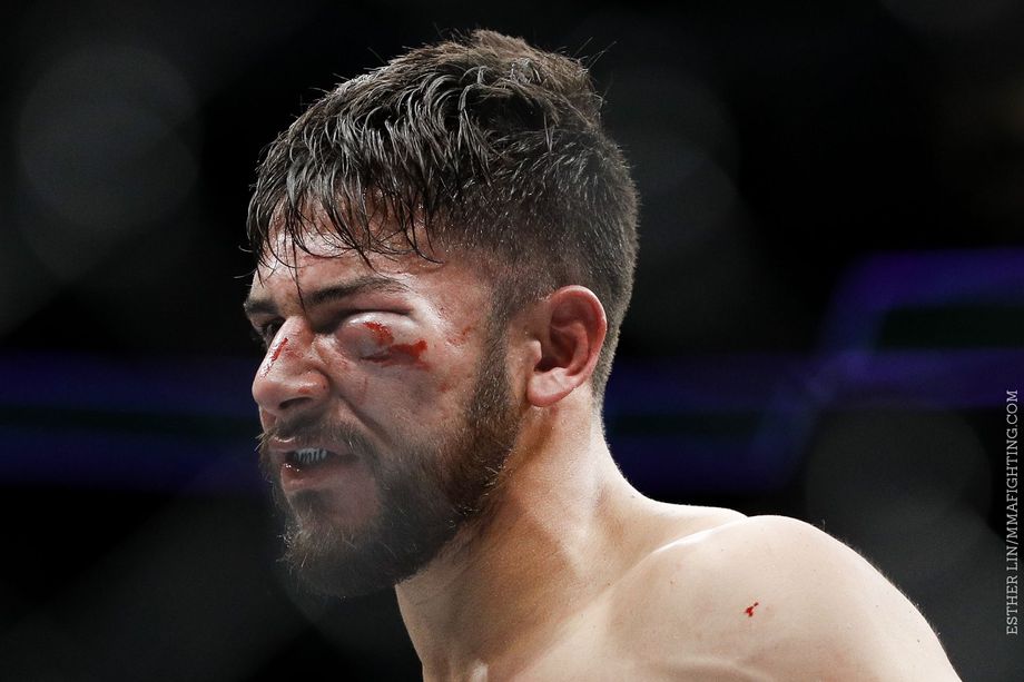 Гематома под глазом не позволила Яиру Родригесу продолжить поединок. Фото: MMA Fighting