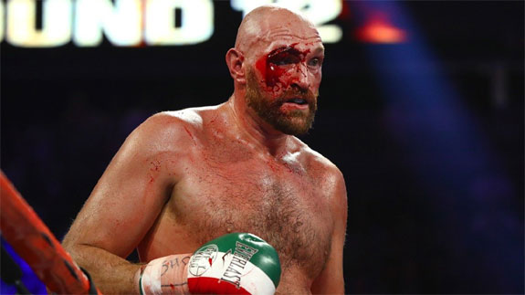 Tyson Fury