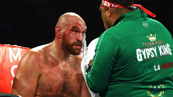 Tyson Fury